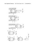 METHOD AND APPARATUS FOR TREATING URETHRAL STRICTURE diagram and image