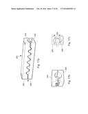 METHOD AND APPARATUS FOR TREATING URETHRAL STRICTURE diagram and image