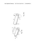 METHOD AND APPARATUS FOR TREATING URETHRAL STRICTURE diagram and image