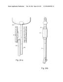 METHOD AND APPARATUS FOR TREATING URETHRAL STRICTURE diagram and image