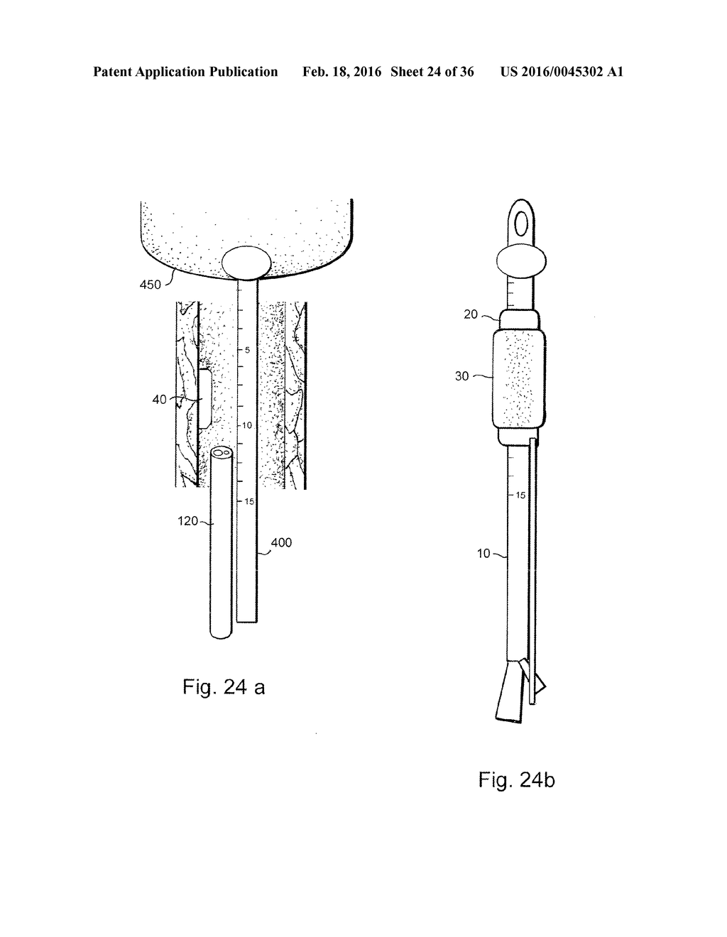 METHOD AND APPARATUS FOR TREATING URETHRAL STRICTURE - diagram, schematic, and image 25