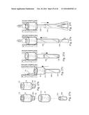 METHOD AND APPARATUS FOR TREATING URETHRAL STRICTURE diagram and image