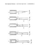 METHOD AND APPARATUS FOR TREATING URETHRAL STRICTURE diagram and image