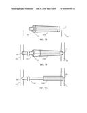 EXTERNAL SUPPORT FOR ELONGATED BODILY VESSELS diagram and image