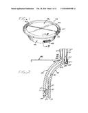 Heart Valve Annulus Device and Method of Using Same diagram and image