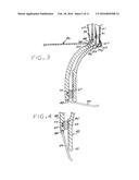 Heart Valve Annulus Device and Method of Using Same diagram and image