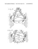 Heart Valve Annulus Device and Method of Using Same diagram and image