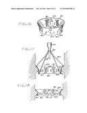 Heart Valve Annulus Device and Method of Using Same diagram and image