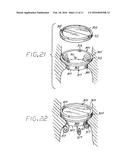 Heart Valve Annulus Device and Method of Using Same diagram and image