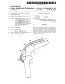 Spacers for Redistributing Forces for the Patella diagram and image