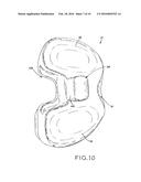 TIBIAL BEARING COMPONENT FOR A KNEE PROSTHESIS WITH IMPROVED ARTICULAR     CHARACTERISTICS diagram and image