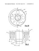 GLENOID IMPLANT diagram and image