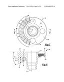 GLENOID IMPLANT diagram and image