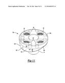 GLENOID IMPLANT diagram and image