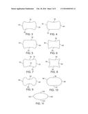 BIODEGRADABLE ENDOPROSTHESES AND METHODS OF THEIR FABRICATION diagram and image