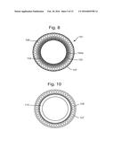 IMPLANT CONTAINING RODS diagram and image