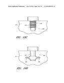 IMPLANTS WITH CONTROLLED DRUG DELIVERY FEATURES AND METHODS OF USING SAME diagram and image