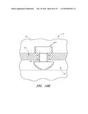 IMPLANTS WITH CONTROLLED DRUG DELIVERY FEATURES AND METHODS OF USING SAME diagram and image