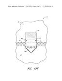 IMPLANTS WITH CONTROLLED DRUG DELIVERY FEATURES AND METHODS OF USING SAME diagram and image