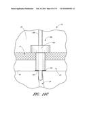 IMPLANTS WITH CONTROLLED DRUG DELIVERY FEATURES AND METHODS OF USING SAME diagram and image