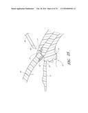 IMPLANTS WITH CONTROLLED DRUG DELIVERY FEATURES AND METHODS OF USING SAME diagram and image