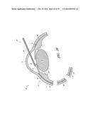 IMPLANTS WITH CONTROLLED DRUG DELIVERY FEATURES AND METHODS OF USING SAME diagram and image