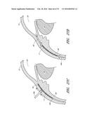 IMPLANTS WITH CONTROLLED DRUG DELIVERY FEATURES AND METHODS OF USING SAME diagram and image