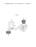 COMBINED LASER AND PHACOEMULSIFICATION SYSTEM FOR EYE SURGERY diagram and image