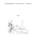 COMBINED LASER AND PHACOEMULSIFICATION SYSTEM FOR EYE SURGERY diagram and image