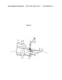 COMBINED LASER AND PHACOEMULSIFICATION SYSTEM FOR EYE SURGERY diagram and image