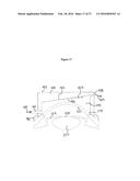 COMBINED LASER AND PHACOEMULSIFICATION SYSTEM FOR EYE SURGERY diagram and image