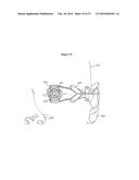 COMBINED LASER AND PHACOEMULSIFICATION SYSTEM FOR EYE SURGERY diagram and image