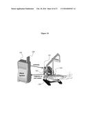 COMBINED LASER AND PHACOEMULSIFICATION SYSTEM FOR EYE SURGERY diagram and image