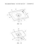 Modifiable Occlusive Skin Dressing diagram and image