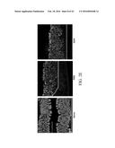 EDIBLE PLANT-DERIVED MICROVESICLE COMPOSITIONS INCLUDING CONJUGATED     THERAPEUTIC AGENTS AND METHODS FOR USING THE SAME diagram and image