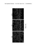 EDIBLE PLANT-DERIVED MICROVESICLE COMPOSITIONS INCLUDING CONJUGATED     THERAPEUTIC AGENTS AND METHODS FOR USING THE SAME diagram and image