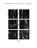 EDIBLE PLANT-DERIVED MICROVESICLE COMPOSITIONS INCLUDING CONJUGATED     THERAPEUTIC AGENTS AND METHODS FOR USING THE SAME diagram and image