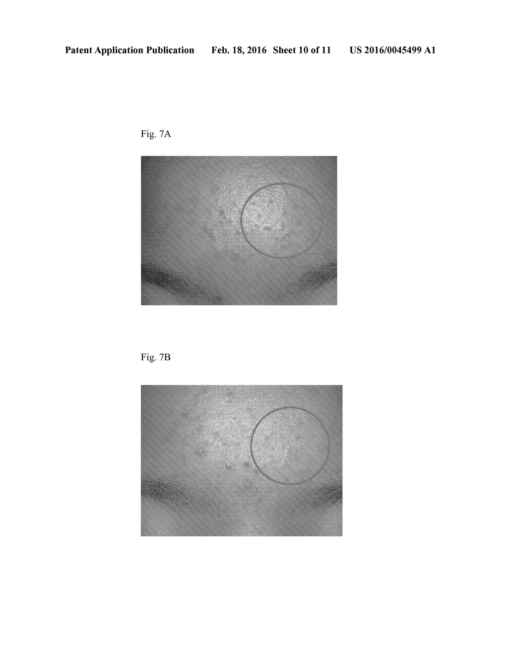 MINOXIDIL FOR SUPPRESSING ANDROGEN RECEPTOR FUNCTION - diagram, schematic, and image 11