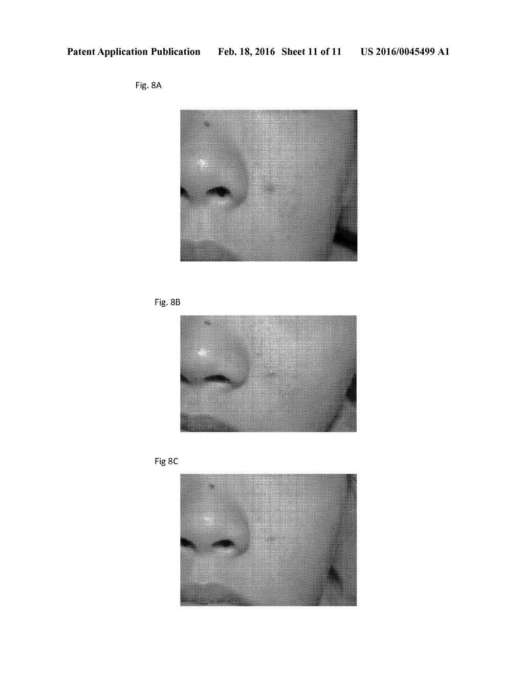 MINOXIDIL FOR SUPPRESSING ANDROGEN RECEPTOR FUNCTION - diagram, schematic, and image 12