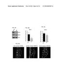 INHIBITION OF CHOROIDAL NEOVASCULARIZATION diagram and image