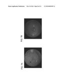 INHIBITION OF CHOROIDAL NEOVASCULARIZATION diagram and image