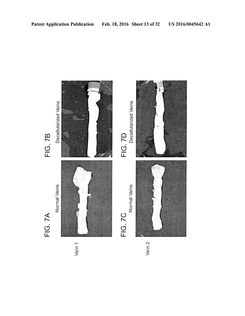 BIOENGINEERED ALLOGENEIC BLOOD VESSEL - diagram, schematic, and image 14