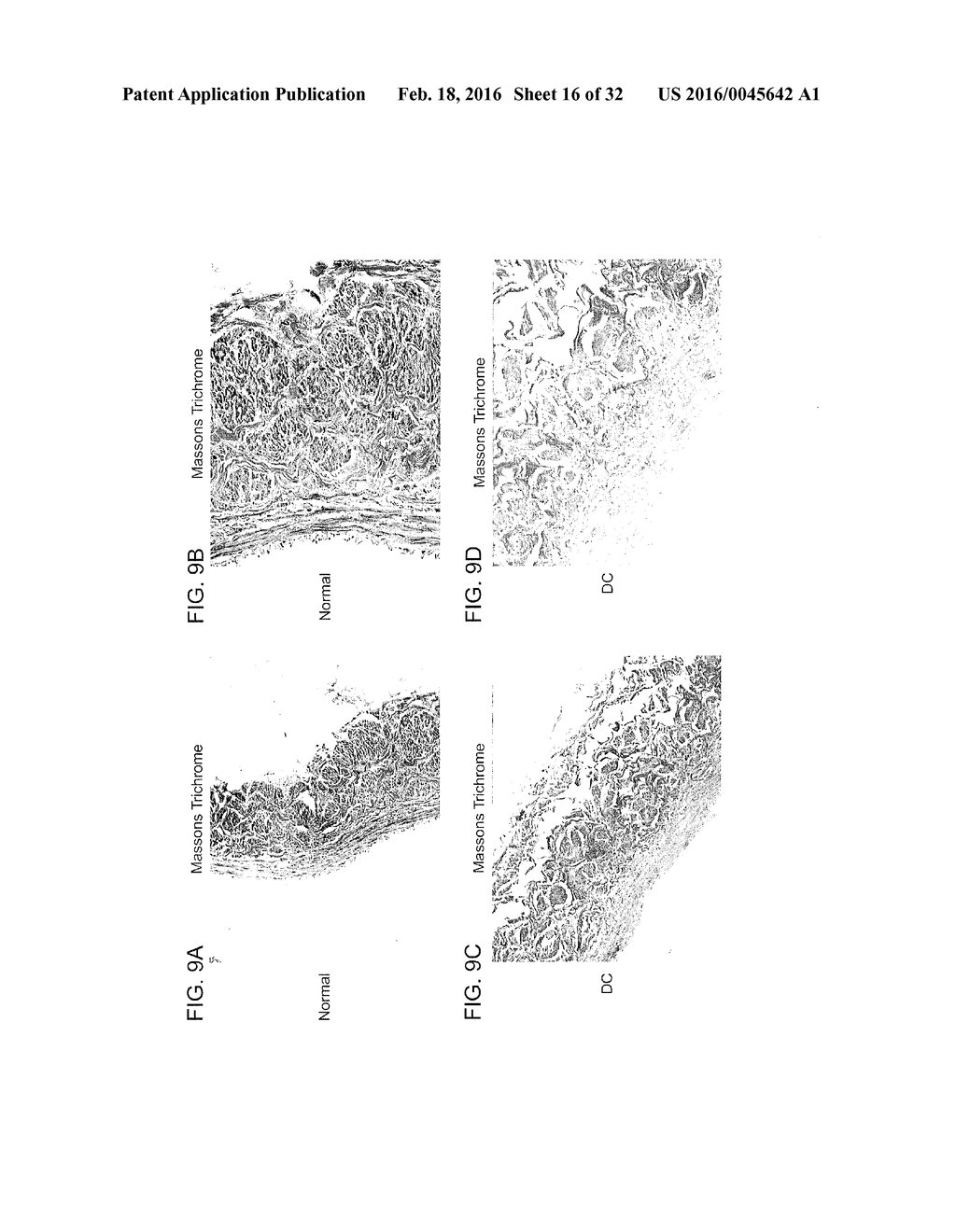 BIOENGINEERED ALLOGENEIC BLOOD VESSEL - diagram, schematic, and image 17