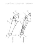 STEERING CONTROL MECHANISM FOR CATHETER diagram and image