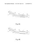 SHAFT SYSTEM FOR BALLOON DILATION diagram and image