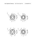 SHAFT SYSTEM FOR BALLOON DILATION diagram and image