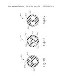 SHAFT SYSTEM FOR BALLOON DILATION diagram and image