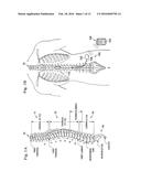 TOUCH SCREEN FINGER POSITION INDICATOR FOR A SPINAL CORD STIMULATION     PROGRAMMING DEVICE diagram and image