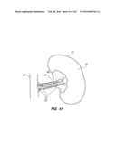 SYSTEM AND METHOD FOR OPTOGENETIC THERAPY diagram and image