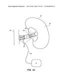 SYSTEM AND METHOD FOR OPTOGENETIC THERAPY diagram and image